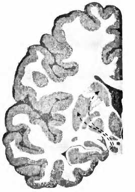 Иллюстрация к книге — Мы - это наш мозг. От матки до Альцгеймера [i_033.jpg]