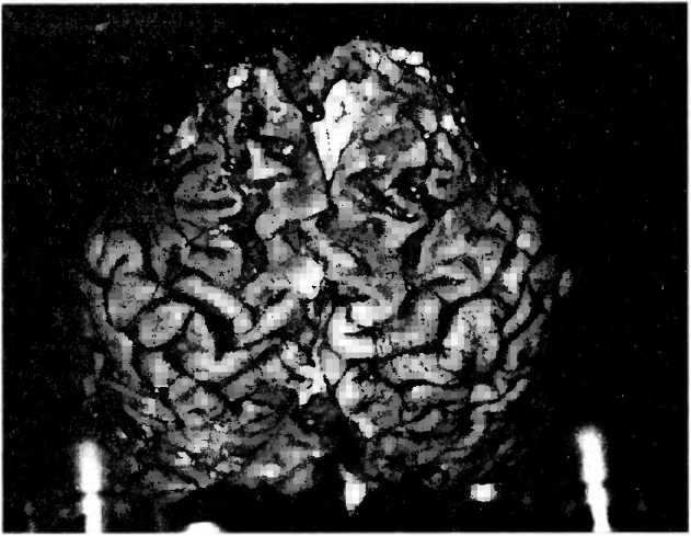 Иллюстрация к книге — Мы - это наш мозг. От матки до Альцгеймера [i_041.jpg]