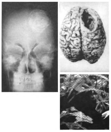 Иллюстрация к книге — Паразит - царь природы. Тайный мир самых опасных существ на Земле [img16e5.jpg]