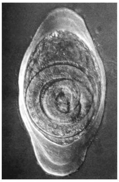 Иллюстрация к книге — Паразит - царь природы. Тайный мир самых опасных существ на Земле [img357d.jpg]