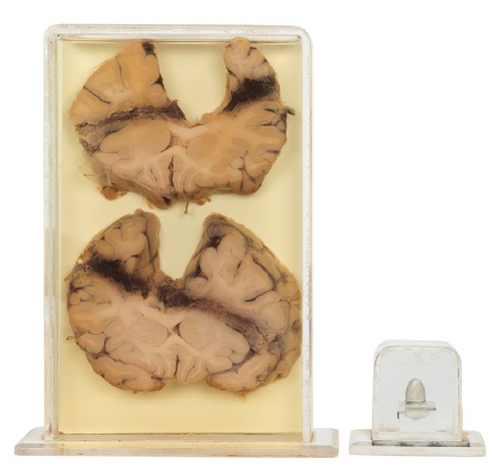 Иллюстрация к книге — Анатомия преступления. Что могут рассказать насекомые, отпечатки пальцев и ДНК [i_052.jpg]