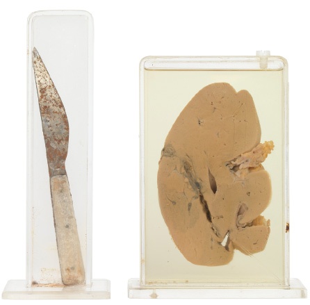 Иллюстрация к книге — Анатомия преступления. Что могут рассказать насекомые, отпечатки пальцев и ДНК [i_053.jpg]