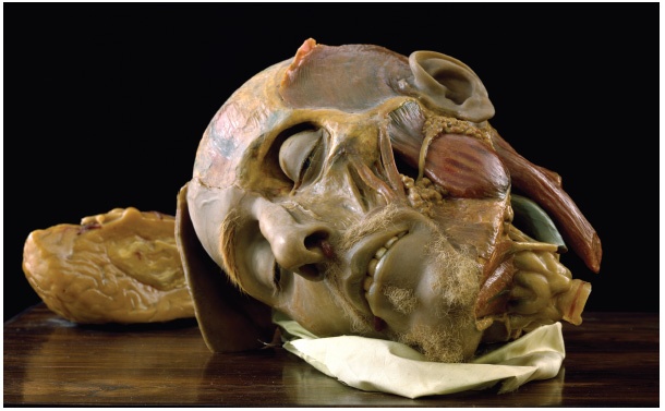 Иллюстрация к книге — Анатомия преступления. Что могут рассказать насекомые, отпечатки пальцев и ДНК [i_055.jpg]