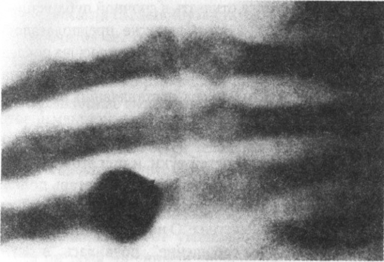 Иллюстрация к книге — Десять величайших открытий в истории медицины [i_014.jpg]