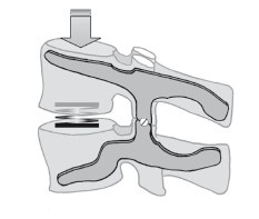 Иллюстрация к книге — Диагностика и лечение позвоночника. Уникальная система доктора А. М. Уриа [i_037.jpg]