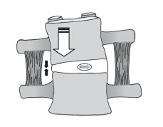 Иллюстрация к книге — Диагностика и лечение позвоночника. Уникальная система доктора А. М. Уриа [i_041.jpg]