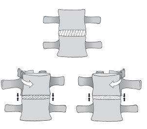Иллюстрация к книге — Диагностика и лечение позвоночника. Уникальная система доктора А. М. Уриа [i_042.jpg]