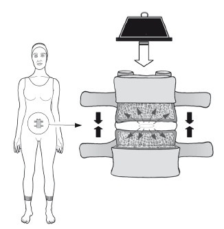 Иллюстрация к книге — Диагностика и лечение позвоночника. Уникальная система доктора А. М. Уриа [i_055.jpg]