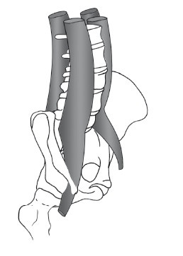 Иллюстрация к книге — Диагностика и лечение позвоночника. Уникальная система доктора А. М. Уриа [i_187.jpg]