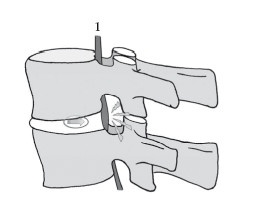 Иллюстрация к книге — Диагностика и лечение позвоночника. Уникальная система доктора А. М. Уриа [i_247.jpg]