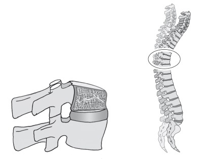 Иллюстрация к книге — Диагностика и лечение позвоночника. Уникальная система доктора А. М. Уриа [i_260.jpg]