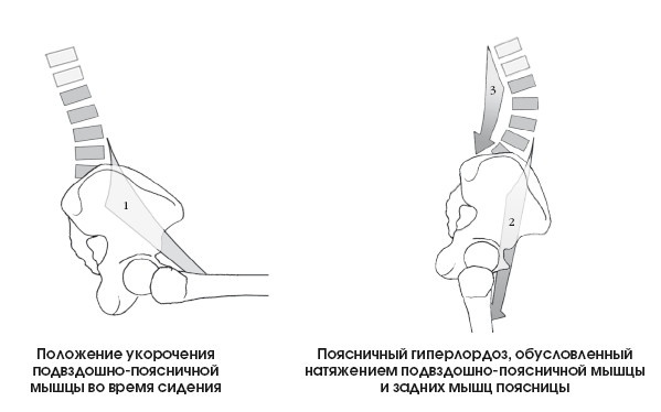 Иллюстрация к книге — Диагностика и лечение позвоночника. Уникальная система доктора А. М. Уриа [i_264.jpg]