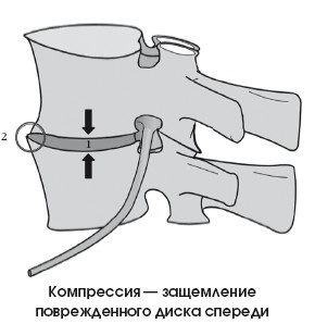 Иллюстрация к книге — Диагностика и лечение позвоночника. Уникальная система доктора А. М. Уриа [i_276.jpg]