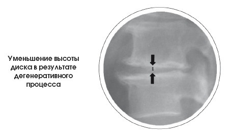 Иллюстрация к книге — Диагностика и лечение позвоночника. Уникальная система доктора А. М. Уриа [i_277.jpg]