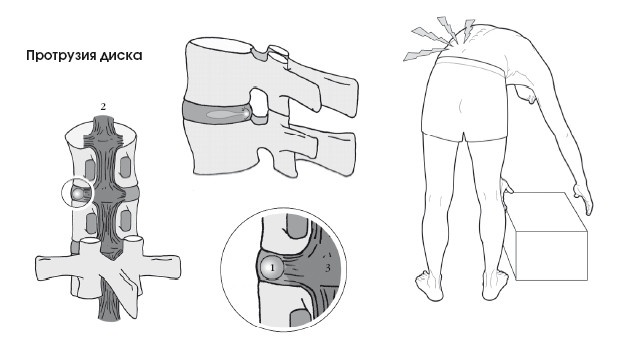 Иллюстрация к книге — Диагностика и лечение позвоночника. Уникальная система доктора А. М. Уриа [i_280.jpg]