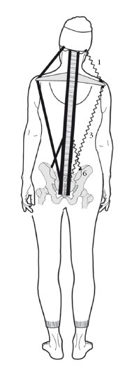 Иллюстрация к книге — Диагностика и лечение позвоночника. Уникальная система доктора А. М. Уриа [i_311.jpg]