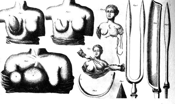Иллюстрация к книге — История груди [i_086.jpg]
