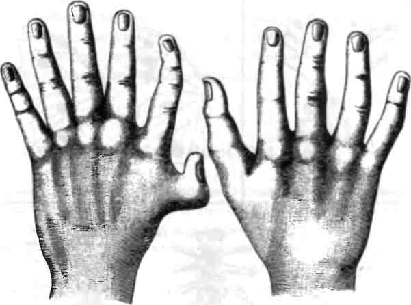 Иллюстрация к книге — Бесконечное число самых прекрасных форм [img_22.jpg]