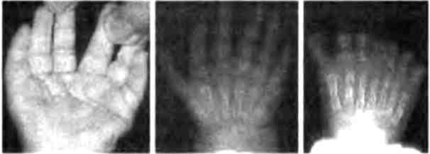 Иллюстрация к книге — Бесконечное число самых прекрасных форм [img_23.jpg]