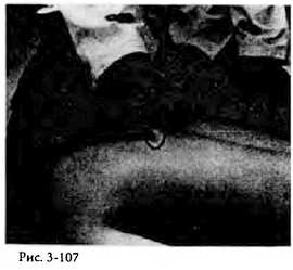 Иллюстрация к книге — Китайский цигун-массаж. Общий массаж [_107.jpg]