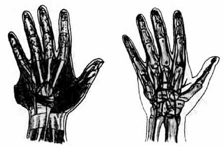 Иллюстрация к книге — Китайский цигун-массаж. Общий массаж [_154.jpg]