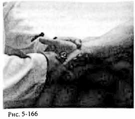 Иллюстрация к книге — Китайский цигун-массаж. Общий массаж [_166.jpg]