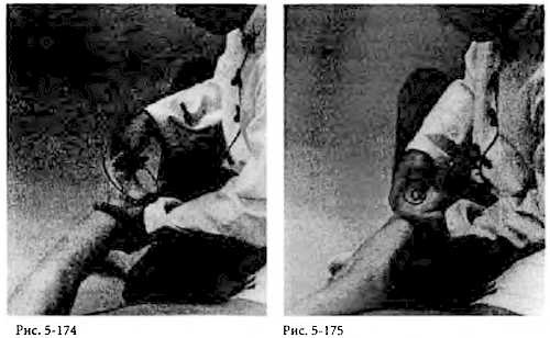 Иллюстрация к книге — Китайский цигун-массаж. Общий массаж [_175.jpg]