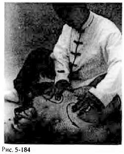 Иллюстрация к книге — Китайский цигун-массаж. Общий массаж [_184.jpg]