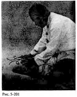 Иллюстрация к книге — Китайский цигун-массаж. Общий массаж [_201.jpg]