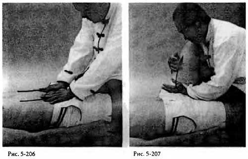 Иллюстрация к книге — Китайский цигун-массаж. Общий массаж [_207.jpg]