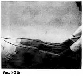 Иллюстрация к книге — Китайский цигун-массаж. Общий массаж [_216.jpg]