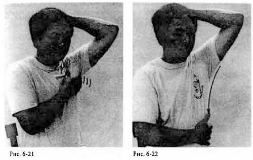 Иллюстрация к книге — Китайский цигун-массаж. Общий массаж [_22.jpg]