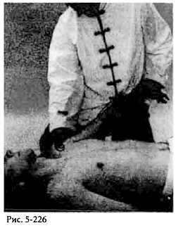 Иллюстрация к книге — Китайский цигун-массаж. Общий массаж [_226.jpg]