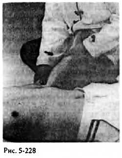 Иллюстрация к книге — Китайский цигун-массаж. Общий массаж [_228.jpg]