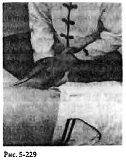 Иллюстрация к книге — Китайский цигун-массаж. Общий массаж [_229.jpg]