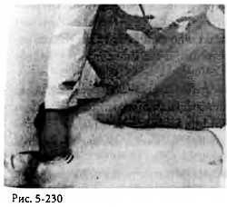 Иллюстрация к книге — Китайский цигун-массаж. Общий массаж [_230.jpg]