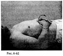 Иллюстрация к книге — Китайский цигун-массаж. Общий массаж [_62.jpg]