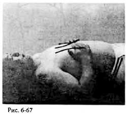 Иллюстрация к книге — Китайский цигун-массаж. Общий массаж [_67.jpg]