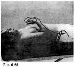 Иллюстрация к книге — Китайский цигун-массаж. Общий массаж [_68.jpg]