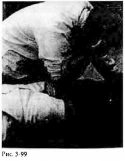 Иллюстрация к книге — Китайский цигун-массаж. Общий массаж [_99.jpg]