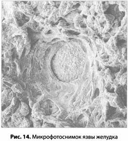 Иллюстрация к книге — Психология стресса [_15.jpg]