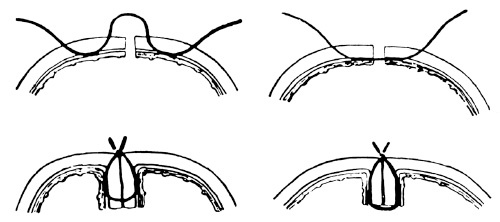 Иллюстрация к книге — Век хирургов [_29.jpg]