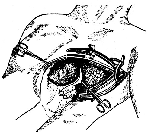Иллюстрация к книге — Век хирургов [_35.jpg]