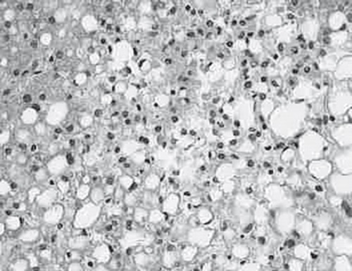 Иллюстрация к книге — Неалкогольная жировая болезнь печени [i_029.jpg]