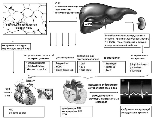 Иллюстрация к книге — Неалкогольная жировая болезнь печени [i_037.jpg]