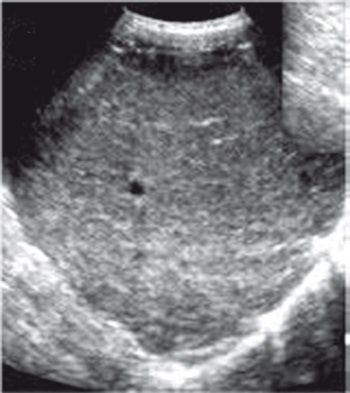 Иллюстрация к книге — Неалкогольная жировая болезнь печени [i_038.jpg]