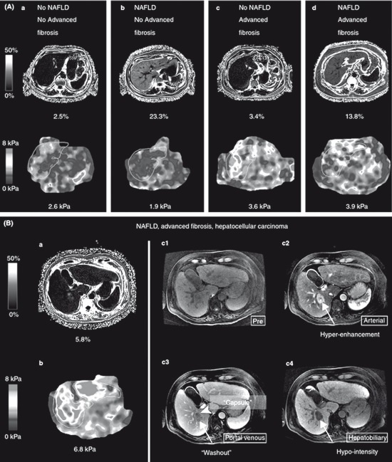 Иллюстрация к книге — Неалкогольная жировая болезнь печени [i_039.jpg]