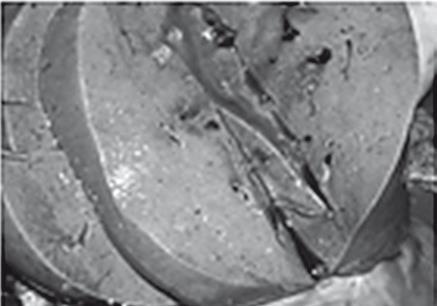 Иллюстрация к книге — Неалкогольная жировая болезнь печени [i_041.jpg]