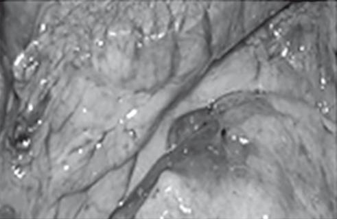 Иллюстрация к книге — Неалкогольная жировая болезнь печени [i_043.jpg]