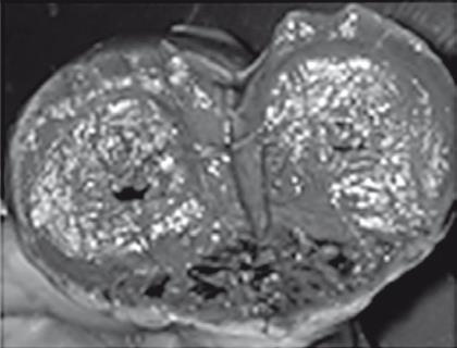 Иллюстрация к книге — Неалкогольная жировая болезнь печени [i_044.jpg]